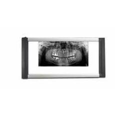 Dental X-Ray Viewer Box (Bio-X)