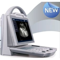 Diagnovision KX-5600 Portable Ultrasound Machine