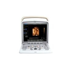 Chison Q5 Ultrasound Machine