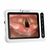 Hugemed Anesthesia Video Laryngoscope with 8 Inch Monitor