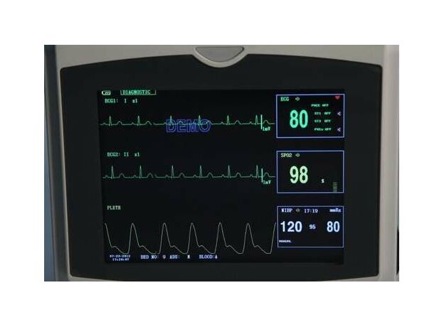 CONTEC CMS6000 Patient Monitor