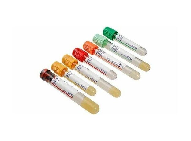 Becton Dickinson (BD) Vaccutainer Blood Collection Tubes - Citrate , Size 13 x 75 2.7 ml Box of 100