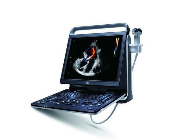 Chison EBit 60 Cardiac Imaging Echocardiogram Machine