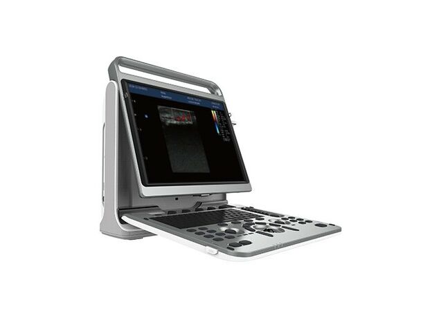 Chison SonoBook 8 Color Doppler Ultrasound Scanner