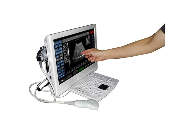 Diagnovision Utouch Portable Color Doppler Ultrasound Machine