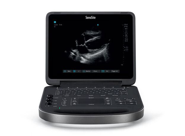 Fujifilm Sonosite Veterinary Portable Ultrasound Machine