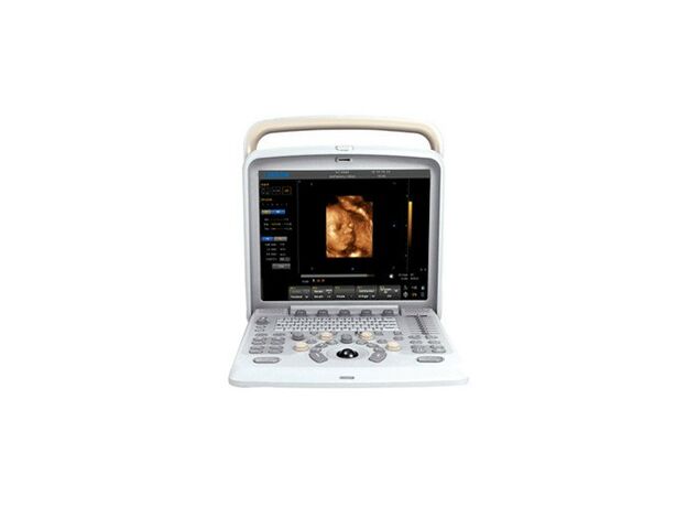 Chison Q5 Ultrasound Machine