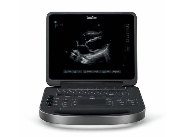 Fujifilm Diagnostic Portable Ultrasound Machine