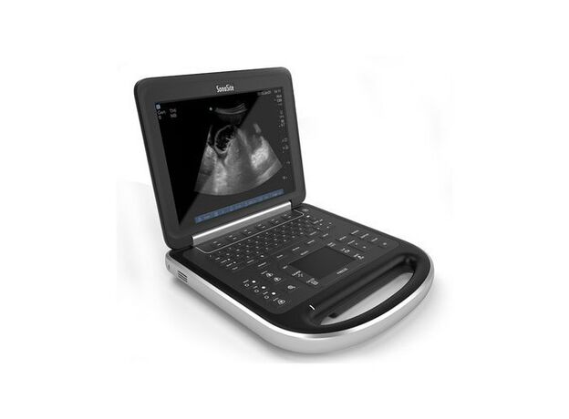 Fujifilm Sonosite EDGE II Portable Ultrasound Machine 